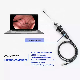 Tuyou 60fps HD USB 3.0 Medical Portable Endoscope Camera for PC Laptop Computer Windows