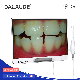  Professional Dentist Assistant Dental Digital Camera Recording Oral Situation